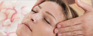acupuncture non-surgical facelift